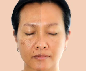 Chống Lão Hóa Da Từ Tuổi 25-moi